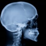 Firefly_X-ray image of a male skull 947757